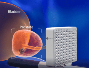 trus biopsy βιοψία προστάτη